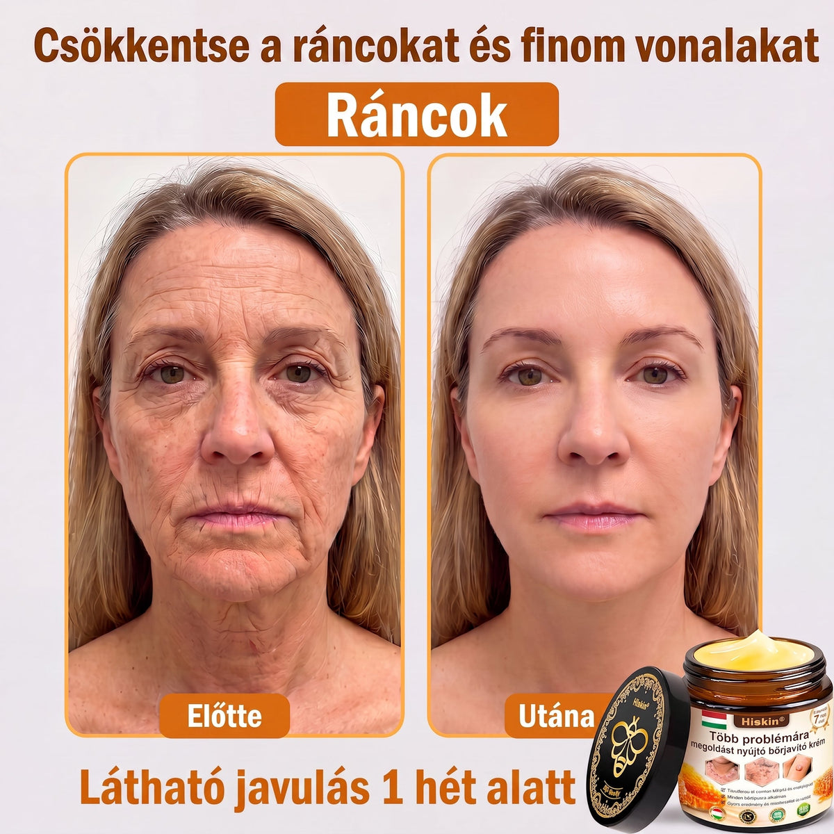 𝐇𝐈𝐒𝐊𝐈𝐍® 𝐓ö𝐛𝐛𝐟𝐮𝐧𝐤𝐜𝐢ó𝐬 𝐁ő𝐫𝐦𝐞𝐠ú𝐣í𝐭ó 𝐊𝐫é𝐦 ✨(𝐄𝐠𝐲𝐞𝐭𝐥𝐞𝐧 ü𝐭ő𝐬 𝐤𝐫é𝐦, 𝐚𝐦𝐢 𝐞𝐠𝐲𝐬𝐳𝐞𝐫𝐫𝐞 𝐯𝐞𝐬𝐳𝐢 𝐜é𝐥𝐛𝐚 𝐚 𝐤𝐢𝐩𝐢𝐫𝐨𝐬𝐨𝐝á𝐬𝐭, 𝐬𝐳á𝐫𝐚𝐳𝐬á𝐠𝐨𝐭, 𝐫á𝐧𝐜𝐨𝐤𝐚𝐭, 𝐩𝐢𝐠𝐦𝐞𝐧𝐭𝐟𝐨𝐥𝐭𝐨𝐤𝐚𝐭 é𝐬 𝐚 𝐥á𝐭𝐡𝐚𝐭ó 𝐛ő𝐫𝐤á𝐫𝐨𝐬𝐨𝐝á𝐬𝐭.)