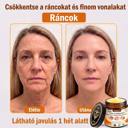 𝐇𝐈𝐒𝐊𝐈𝐍® 𝐓ö𝐛𝐛𝐟𝐮𝐧𝐤𝐜𝐢ó𝐬 𝐁ő𝐫𝐦𝐞𝐠ú𝐣í𝐭ó 𝐊𝐫é𝐦 ✨(𝐄𝐠𝐲𝐞𝐭𝐥𝐞𝐧 ü𝐭ő𝐬 𝐤𝐫é𝐦, 𝐚𝐦𝐢 𝐞𝐠𝐲𝐬𝐳𝐞𝐫𝐫𝐞 𝐯𝐞𝐬𝐳𝐢 𝐜é𝐥𝐛𝐚 𝐚 𝐤𝐢𝐩𝐢𝐫𝐨𝐬𝐨𝐝á𝐬𝐭, 𝐬𝐳á𝐫𝐚𝐳𝐬á𝐠𝐨𝐭, 𝐫á𝐧𝐜𝐨𝐤𝐚𝐭, 𝐩𝐢𝐠𝐦𝐞𝐧𝐭𝐟𝐨𝐥𝐭𝐨𝐤𝐚𝐭 é𝐬 𝐚 𝐥á𝐭𝐡𝐚𝐭ó 𝐛ő𝐫𝐤á𝐫𝐨𝐬𝐨𝐝á𝐬𝐭.)
