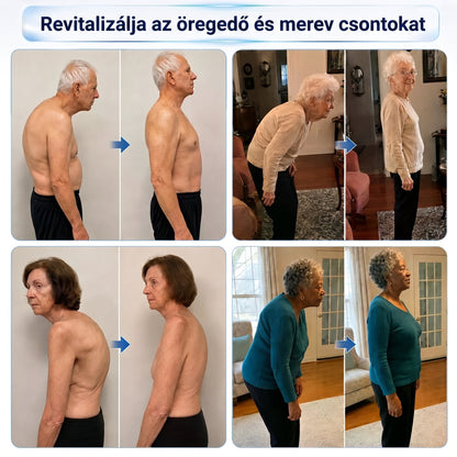 ❤️DR.HONOR® Kompozit Ízületápoló és Javító Roller - 30% Kedvezmény 🦴