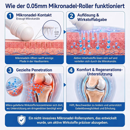 𝐈𝐅𝐌𝗔𝗚𝐈𝐂® 👩‍⚕️ 𝟎,𝟎𝟓 𝐦𝐦 𝐌𝐢𝐤𝐫𝐨𝐧𝐚𝐝𝐞𝐥-𝐑𝐨𝐥𝐥𝐞𝐫 𝐟ü𝐫 𝐊𝐧𝐨𝐜𝐡𝐞𝐧 & 𝐆𝐞𝐥𝐞𝐧𝐤𝐞🍃