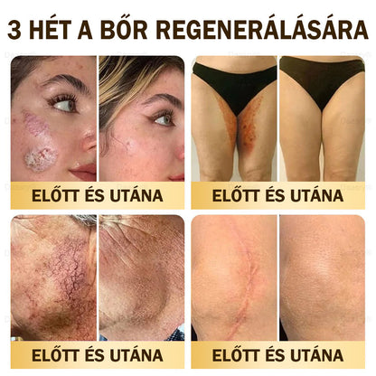 🎇 – 𝓓𝓪𝓪𝓼𝓻𝔂® Méhméreg Bőrjavító Krémkisimítja a ráncokat, hidratál, ragyogóvá teszi a bőrt, hegeket gyógyít, nyugtatja az érzékeny bőrt, és egyenletes tónust ad