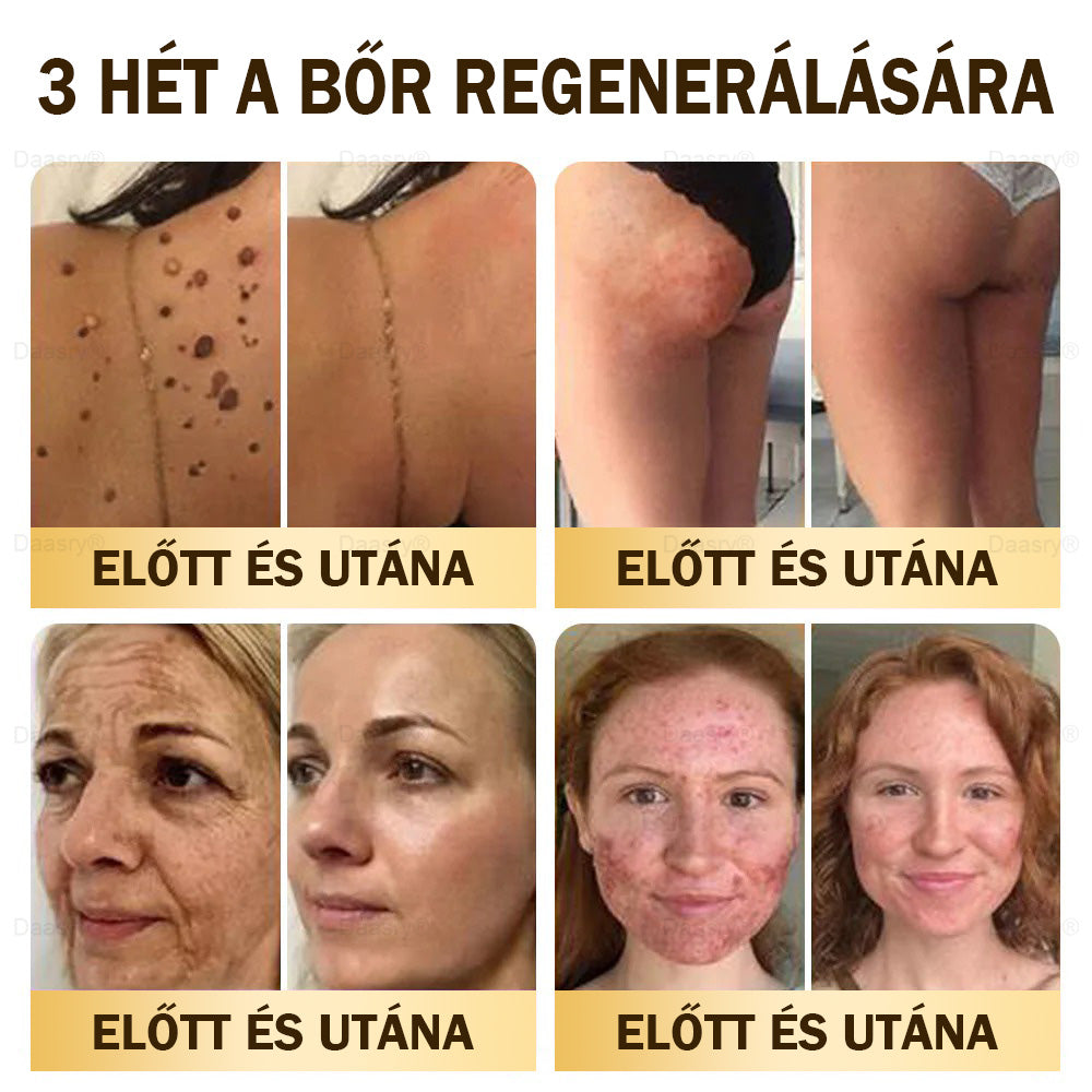 🎇 – 𝓓𝓪𝓪𝓼𝓻𝔂® Méhméreg Bőrjavító Krémkisimítja a ráncokat, hidratál, ragyogóvá teszi a bőrt, hegeket gyógyít, nyugtatja az érzékeny bőrt, és egyenletes tónust ad
