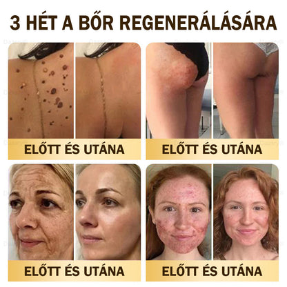 🎇 – 𝓓𝓪𝓪𝓼𝓻𝔂® Méhméreg Bőrjavító Krémkisimítja a ráncokat, hidratál, ragyogóvá teszi a bőrt, hegeket gyógyít, nyugtatja az érzékeny bőrt, és egyenletes tónust ad