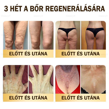 🎇 – 𝓓𝓪𝓪𝓼𝓻𝔂® Méhméreg Bőrjavító Krémkisimítja a ráncokat, hidratál, ragyogóvá teszi a bőrt, hegeket gyógyít, nyugtatja az érzékeny bőrt, és egyenletes tónust ad