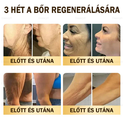 🎇 – 𝓓𝓪𝓪𝓼𝓻𝔂® Méhméreg Bőrjavító Krémkisimítja a ráncokat, hidratál, ragyogóvá teszi a bőrt, hegeket gyógyít, nyugtatja az érzékeny bőrt, és egyenletes tónust ad