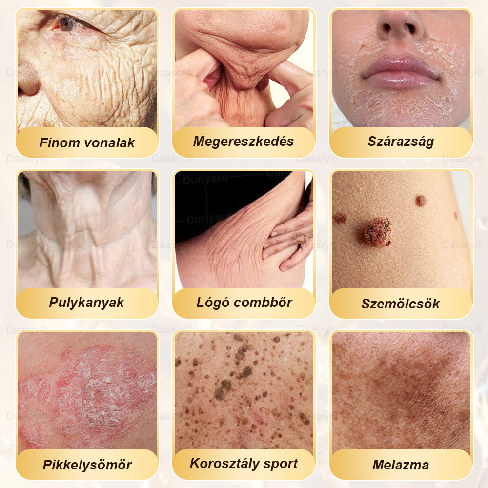🎇 – 𝓓𝓪𝓪𝓼𝓻𝔂® Méhméreg Bőrjavító Krémkisimítja a ráncokat, hidratál, ragyogóvá teszi a bőrt, hegeket gyógyít, nyugtatja az érzékeny bőrt, és egyenletes tónust ad