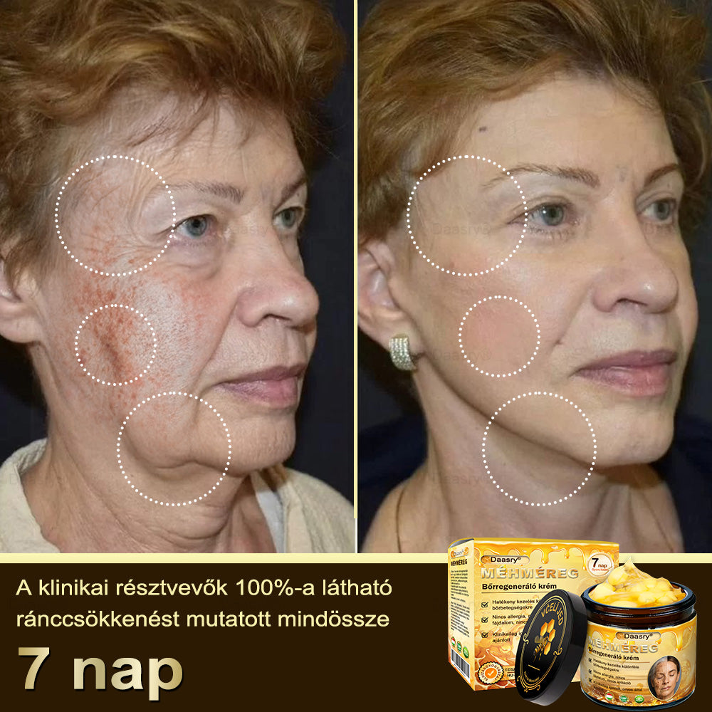 🎇 – 𝓓𝓪𝓪𝓼𝓻𝔂® Méhméreg Bőrjavító Krémkisimítja a ráncokat, hidratál, ragyogóvá teszi a bőrt, hegeket gyógyít, nyugtatja az érzékeny bőrt, és egyenletes tónust ad