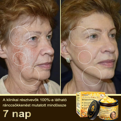 🎇 – 𝓓𝓪𝓪𝓼𝓻𝔂® Méhméreg Bőrjavító Krémkisimítja a ráncokat, hidratál, ragyogóvá teszi a bőrt, hegeket gyógyít, nyugtatja az érzékeny bőrt, és egyenletes tónust ad