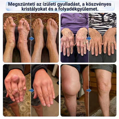 ❤️DR.HONOR® Kompozit Ízületápoló és Javító Roller - 30% Kedvezmény 🦴