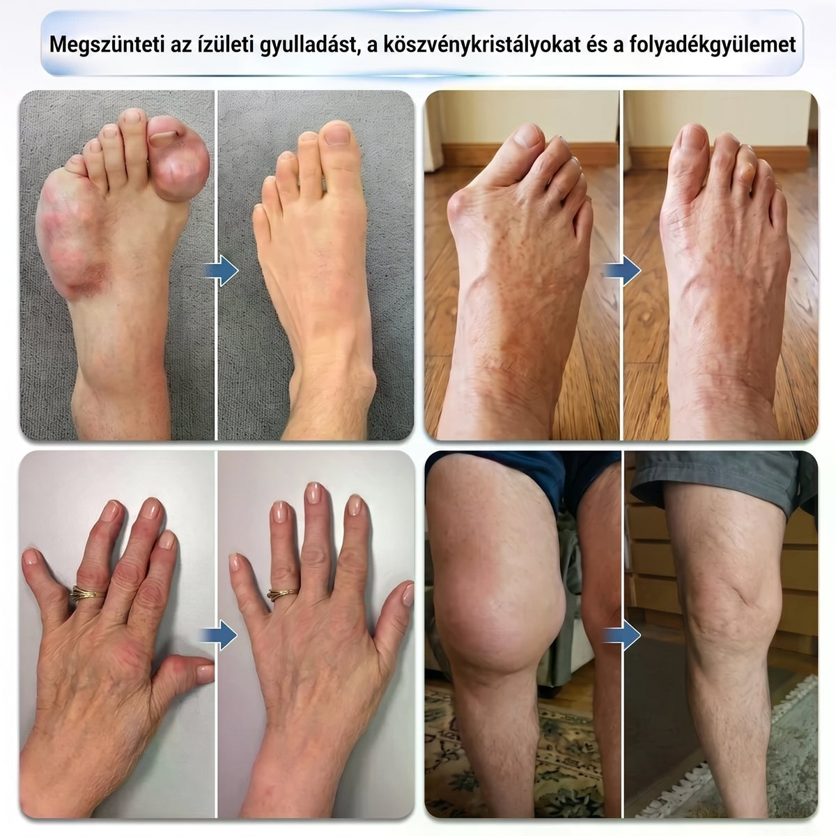 ❤️DR.HONOR® Kompozit Ízületápoló és Javító Roller - 30% Kedvezmény 🦴