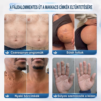 🔥𝐇𝐢𝐯𝐚𝐭𝐚𝐥𝐨𝐬 𝐌á𝐫𝐤𝐚𝐛𝐨𝐥𝐭 | 🚢🚢 𝐇𝐢𝐬𝐤𝐢𝐧® 𝟕 𝐧𝐚𝐩𝐨𝐬 𝐒𝐳𝐞𝐦ö𝐥𝐜𝐬𝐞𝐥𝐭á𝐯𝐨𝐥í𝐭ó 𝐑𝐨𝐥𝐥-𝐨𝐧 Á𝐩𝐨𝐥ó 𝐅𝐨𝐥𝐲𝐚𝐝é𝐤 (𝐅á𝐣𝐝𝐚𝐥𝐨𝐦𝐦𝐞𝐧𝐭𝐞𝐬 𝐫𝐨𝐥𝐥𝐞𝐫𝐛𝐚𝐥𝐥 𝐭𝐞𝐜𝐡𝐧𝐨𝐥ó𝐠𝐢𝐚, 𝐡𝐞𝐠𝐞𝐤 𝐧é𝐥𝐤ü𝐥) 🐬