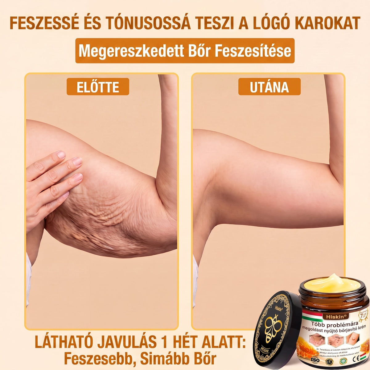 𝐇𝐈𝐒𝐊𝐈𝐍® 𝐓ö𝐛𝐛𝐟𝐮𝐧𝐤𝐜𝐢ó𝐬 𝐁ő𝐫𝐦𝐞𝐠ú𝐣í𝐭ó 𝐊𝐫é𝐦 ✨(𝐄𝐠𝐲𝐞𝐭𝐥𝐞𝐧 ü𝐭ő𝐬 𝐤𝐫é𝐦, 𝐚𝐦𝐢 𝐞𝐠𝐲𝐬𝐳𝐞𝐫𝐫𝐞 𝐯𝐞𝐬𝐳𝐢 𝐜é𝐥𝐛𝐚 𝐚 𝐤𝐢𝐩𝐢𝐫𝐨𝐬𝐨𝐝á𝐬𝐭, 𝐬𝐳á𝐫𝐚𝐳𝐬á𝐠𝐨𝐭, 𝐫á𝐧𝐜𝐨𝐤𝐚𝐭, 𝐩𝐢𝐠𝐦𝐞𝐧𝐭𝐟𝐨𝐥𝐭𝐨𝐤𝐚𝐭 é𝐬 𝐚 𝐥á𝐭𝐡𝐚𝐭ó 𝐛ő𝐫𝐤á𝐫𝐨𝐬𝐨𝐝á𝐬𝐭.)