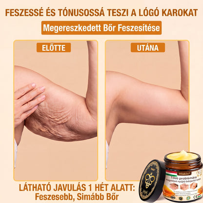 𝐇𝐈𝐒𝐊𝐈𝐍® 𝐓ö𝐛𝐛𝐟𝐮𝐧𝐤𝐜𝐢ó𝐬 𝐁ő𝐫𝐦𝐞𝐠ú𝐣í𝐭ó 𝐊𝐫é𝐦 ✨(𝐄𝐠𝐲𝐞𝐭𝐥𝐞𝐧 ü𝐭ő𝐬 𝐤𝐫é𝐦, 𝐚𝐦𝐢 𝐞𝐠𝐲𝐬𝐳𝐞𝐫𝐫𝐞 𝐯𝐞𝐬𝐳𝐢 𝐜é𝐥𝐛𝐚 𝐚 𝐤𝐢𝐩𝐢𝐫𝐨𝐬𝐨𝐝á𝐬𝐭, 𝐬𝐳á𝐫𝐚𝐳𝐬á𝐠𝐨𝐭, 𝐫á𝐧𝐜𝐨𝐤𝐚𝐭, 𝐩𝐢𝐠𝐦𝐞𝐧𝐭𝐟𝐨𝐥𝐭𝐨𝐤𝐚𝐭 é𝐬 𝐚 𝐥á𝐭𝐡𝐚𝐭ó 𝐛ő𝐫𝐤á𝐫𝐨𝐬𝐨𝐝á𝐬𝐭.)