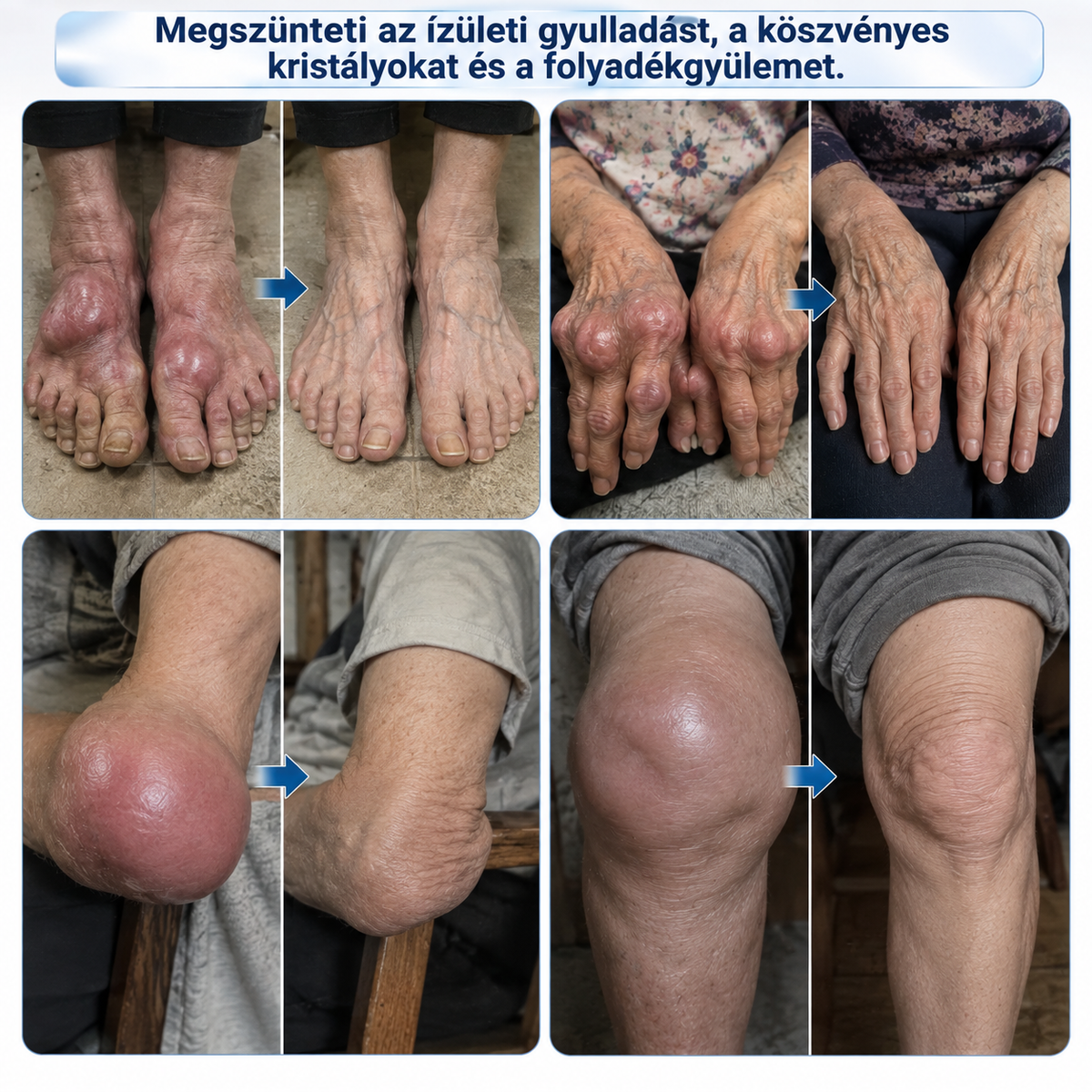 🇭🇺 𝐃𝐑.𝐇𝐎𝐍𝐎𝐑® 𝟏𝟎 𝐚𝐳 𝟏-𝐛𝐞𝐧 𝐇ű𝐬í𝐭ő 𝐑𝐨𝐥𝐥-𝐎𝐧 – Í𝐳ü𝐥𝐞𝐭𝐞𝐤 é𝐬 𝐈𝐳𝐦𝐨𝐤 𝐌𝐢𝐧𝐝𝐞𝐧𝐧𝐚𝐩𝐢 Á𝐩𝐨𝐥á𝐬á𝐫𝐚