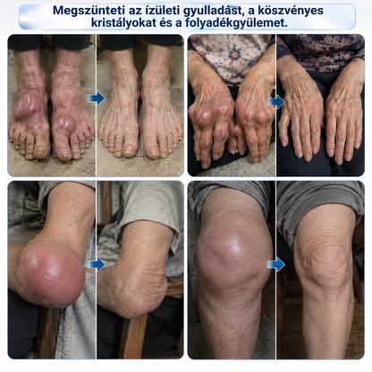 🇭🇺 𝐃𝐑.𝐇𝐎𝐍𝐎𝐑® 𝟏𝟎 𝐚𝐳 𝟏-𝐛𝐞𝐧 𝐇ű𝐬í𝐭ő 𝐑𝐨𝐥𝐥-𝐎𝐧 – Í𝐳ü𝐥𝐞𝐭𝐞𝐤 é𝐬 𝐈𝐳𝐦𝐨𝐤 𝐌𝐢𝐧𝐝𝐞𝐧𝐧𝐚𝐩𝐢 Á𝐩𝐨𝐥á𝐬á𝐫𝐚