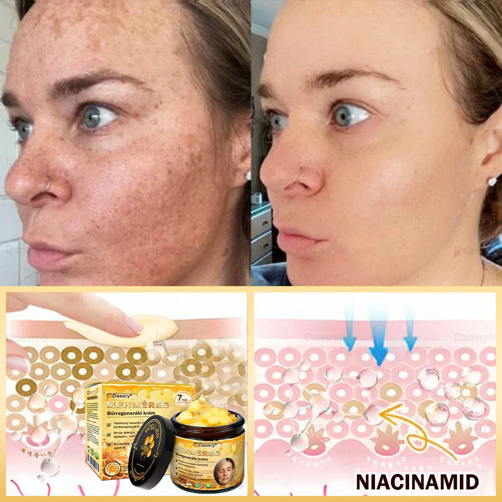 🎇 – 𝓓𝓪𝓪𝓼𝓻𝔂® Méhméreg Bőrjavító Krémkisimítja a ráncokat, hidratál, ragyogóvá teszi a bőrt, hegeket gyógyít, nyugtatja az érzékeny bőrt, és egyenletes tónust ad