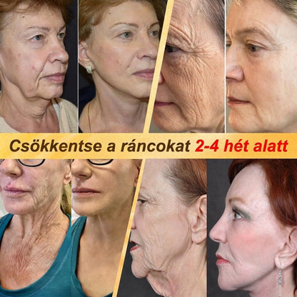 𝐇𝐈𝐒𝐊𝐈𝐍® 𝐓ö𝐛𝐛𝐟𝐮𝐧𝐤𝐜𝐢ó𝐬 𝐁ő𝐫𝐦𝐞𝐠ú𝐣í𝐭ó 𝐊𝐫é𝐦 ✨(𝐄𝐠𝐲𝐞𝐭𝐥𝐞𝐧 ü𝐭ő𝐬 𝐤𝐫é𝐦, 𝐚𝐦𝐢 𝐞𝐠𝐲𝐬𝐳𝐞𝐫𝐫𝐞 𝐯𝐞𝐬𝐳𝐢 𝐜é𝐥𝐛𝐚 𝐚 𝐤𝐢𝐩𝐢𝐫𝐨𝐬𝐨𝐝á𝐬𝐭, 𝐬𝐳á𝐫𝐚𝐳𝐬á𝐠𝐨𝐭, 𝐫á𝐧𝐜𝐨𝐤𝐚𝐭, 𝐩𝐢𝐠𝐦𝐞𝐧𝐭𝐟𝐨𝐥𝐭𝐨𝐤𝐚𝐭 é𝐬 𝐚 𝐥á𝐭𝐡𝐚𝐭ó 𝐛ő𝐫𝐤á𝐫𝐨𝐬𝐨𝐝á𝐬𝐭.)